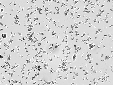 yeast in microscope